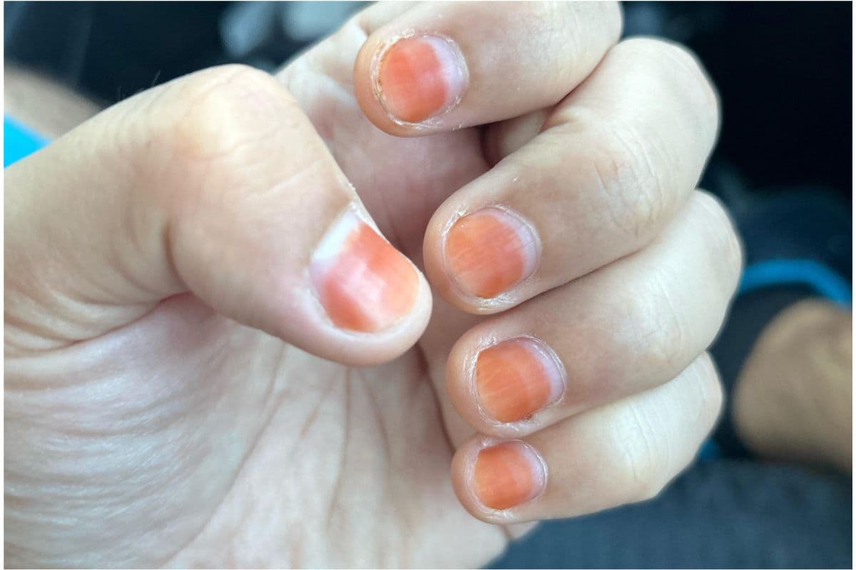 How To Remove Mehndi From Nails: नाखूनों पर चढ़ी मेहंदी हटेगी चुटकियों में,बस अपनाएं ये ट्रिक्स