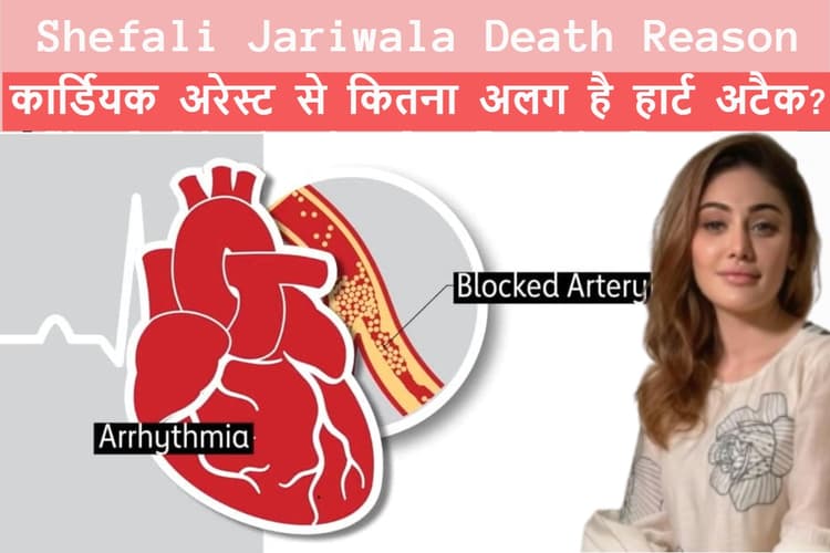 Shefali Jariwala Death: क्या होता है कार्डियक अरेस्ट? हार्ट अटैक से कितना अलग होता है यह? समझिए फर्क, जो बचा सकता है जान