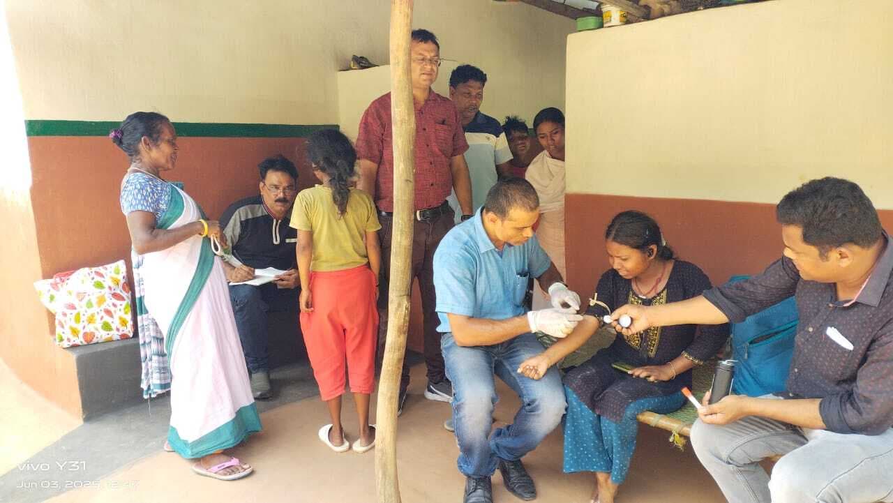 Jamshedpur News : पोटका के झरिया गांव में फैला चिकनपॉक्स, 10 संदिग्ध मरीज मिले, तीन का लिया सैंपल