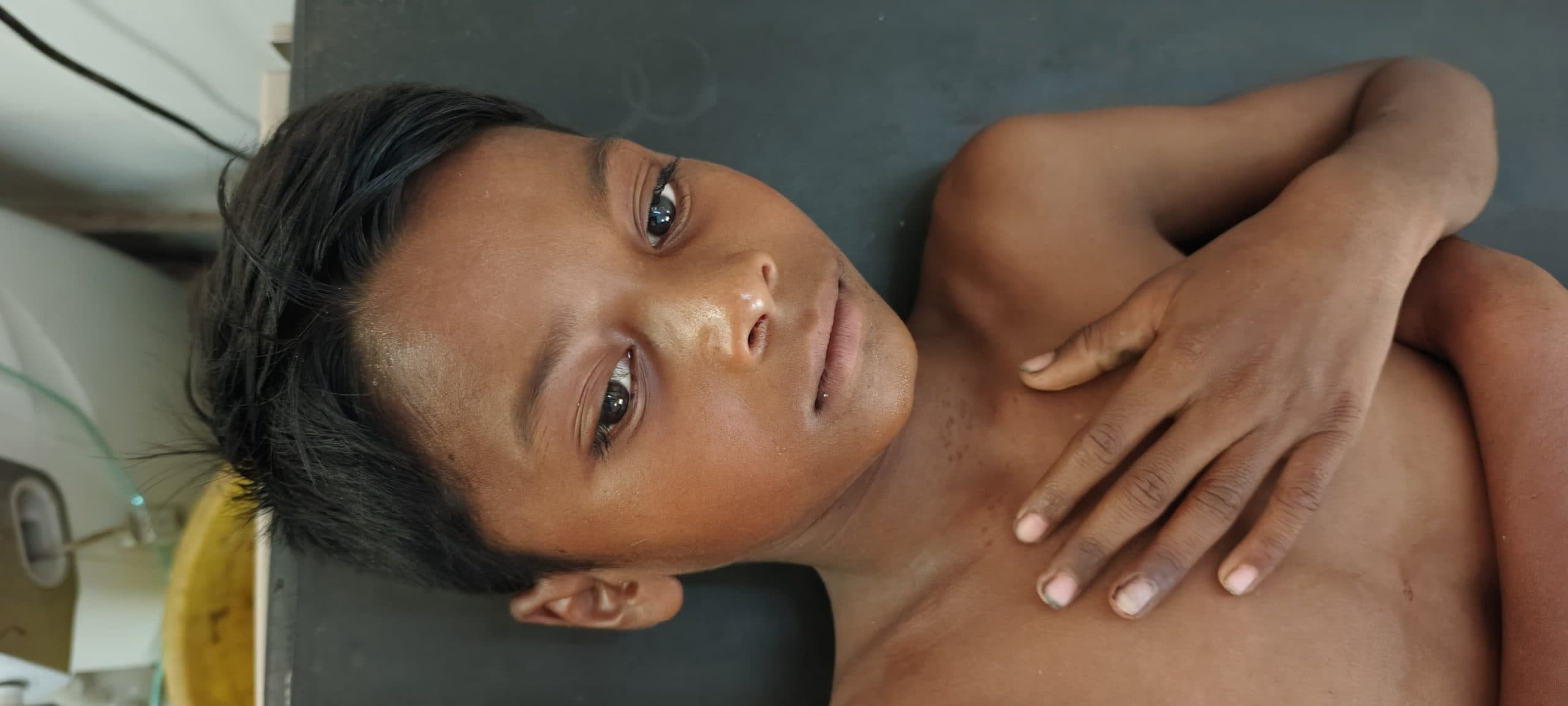 Chaibasa News : मनोहरपुर : छत से गिरने से युवक और बालक हुआ घायल