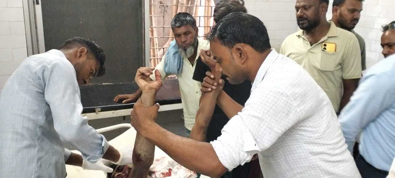 मदनसाही फाटक के समीप बाइक से गिरकर दो युवक घायल