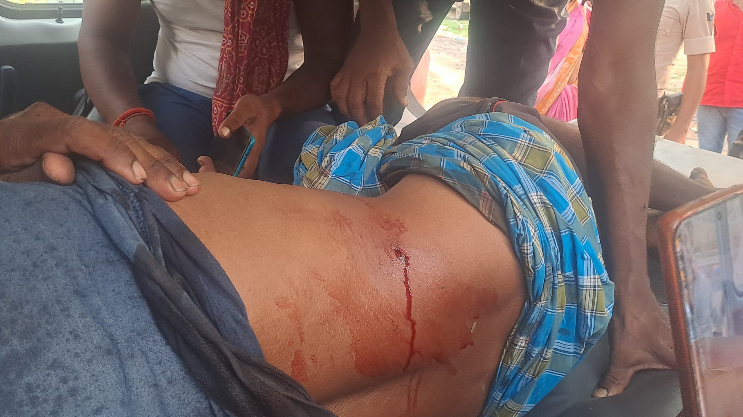 गाय चारा रहे अधेड़ को पेट में मारी गोली, घायल