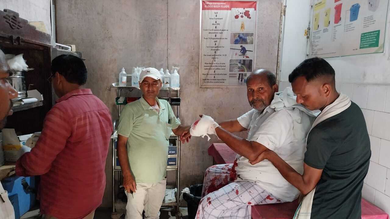 अंबिका उपेंद्र महाविद्यालय में हुई मारपीट, पूर्व प्राचार्य घायल