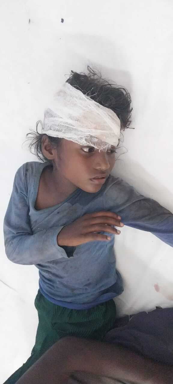 अनियंत्रित होकर कुएं में गिरी किशोरी, हालत गंभीर