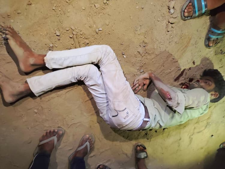 हादसा : गड्ढे में गिर कर बाइक सवार युवक घायल