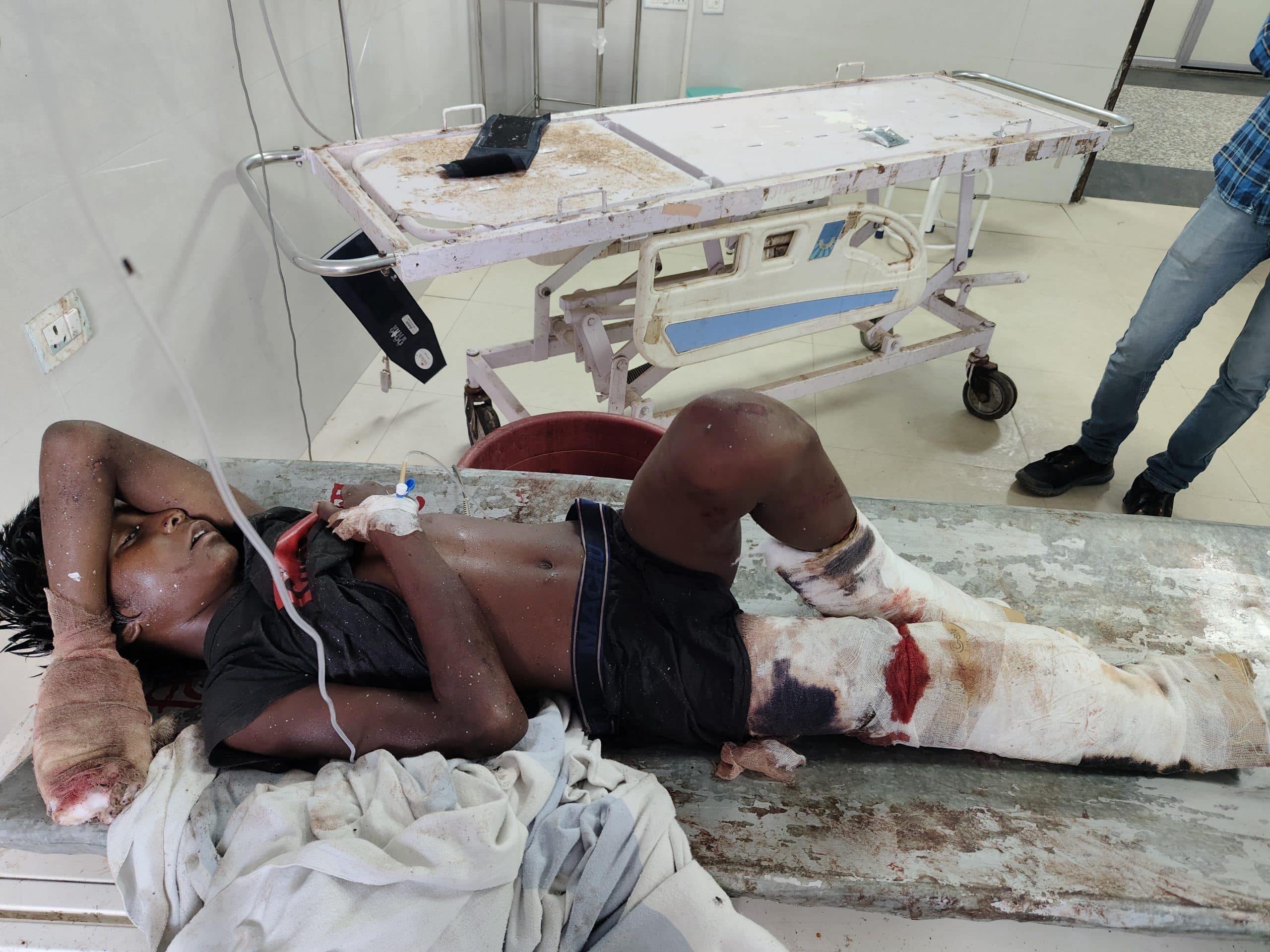 आम के पेड़ से गिरकर युवक जख्मी