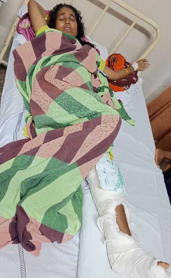 Bokaro News : बारिश में गिरी दीवार, दबकर महिला जख्मी