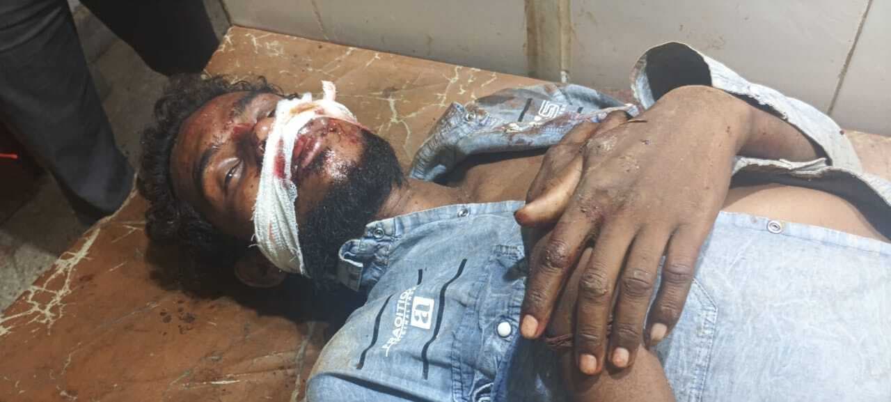 बाइक से गिरकर युवक घायल, धनबाद रेफर