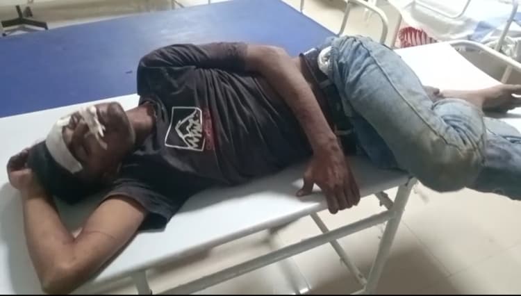 लूटपाट कर भाग रहे दो अपराधी दुर्घटनाग्रस्त