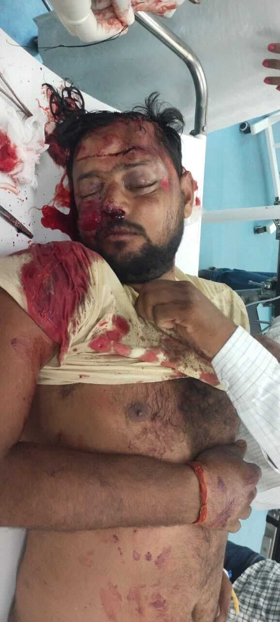 अज्ञात वाहन के धक्के से युवक की हालत गंभीर