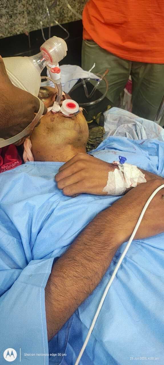 सड़क हादसे में बाइक सवार दो युवकों की हालत गंभीर