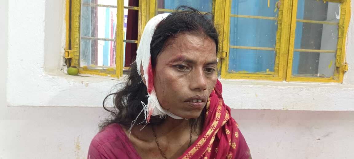 जमीन विवाद में हुई मारपीट, आधे दर्जन लोग जख्मी