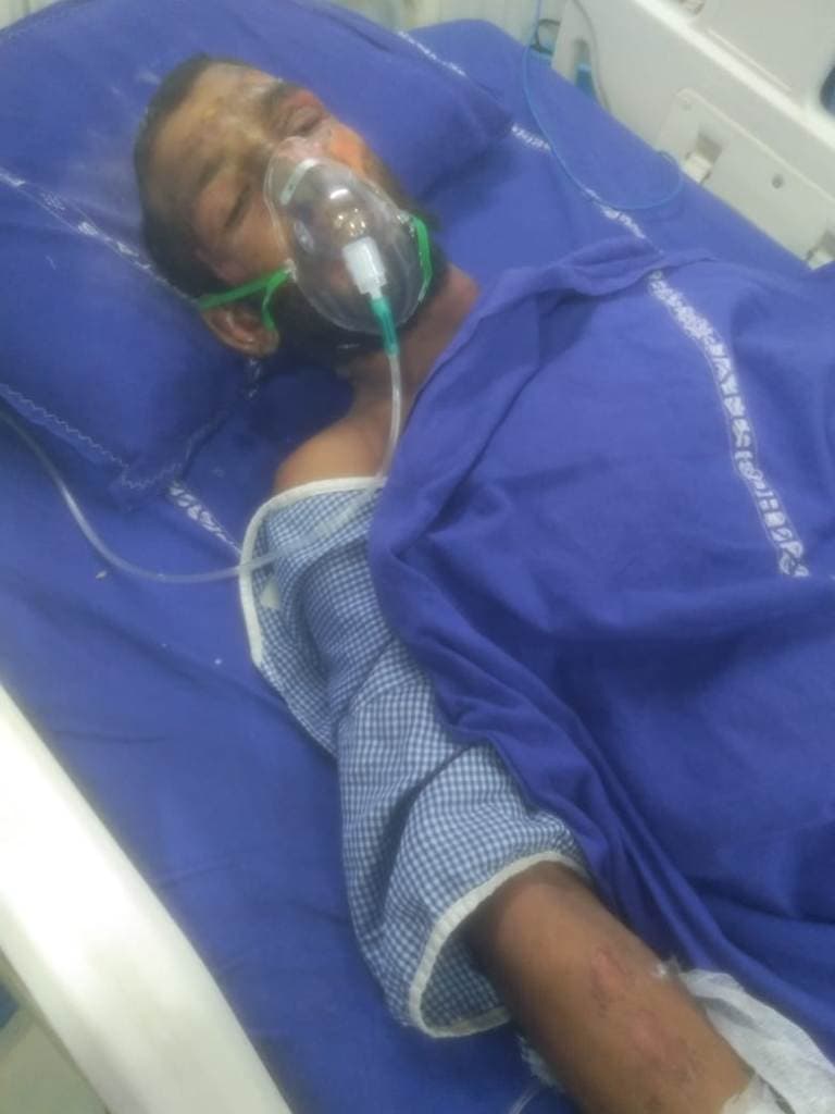 तेलंगाना के केमिकल फैक्ट्री अग्निकांड : डब्लू बोला- मां बड़ी मुश्किल से मेरी जान बची है, साथ काम करने वाले शायद नहीं निकल पाये