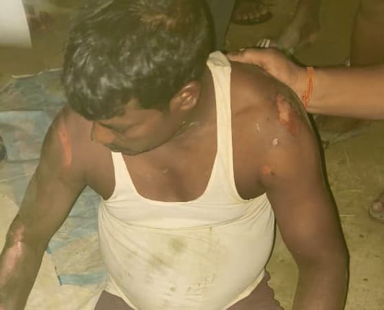 रामपुर तिलक में आग से तीन घर जलकर राख, युवक घायल