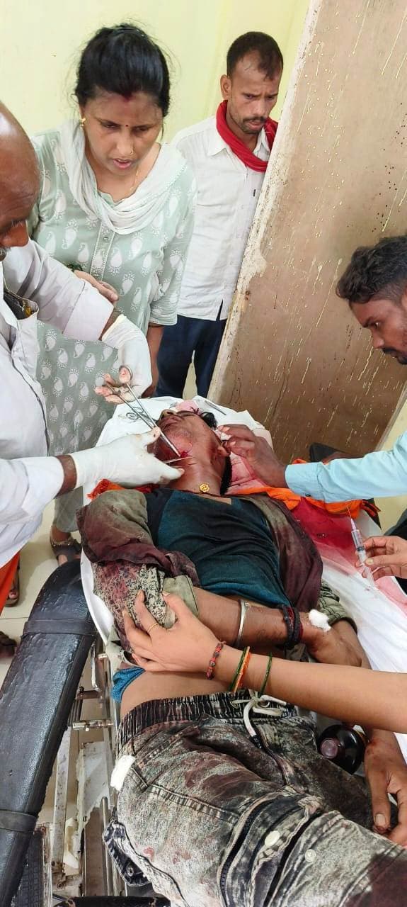 अनियंत्रित होकर टोटो से टकराई बस, दो घायल