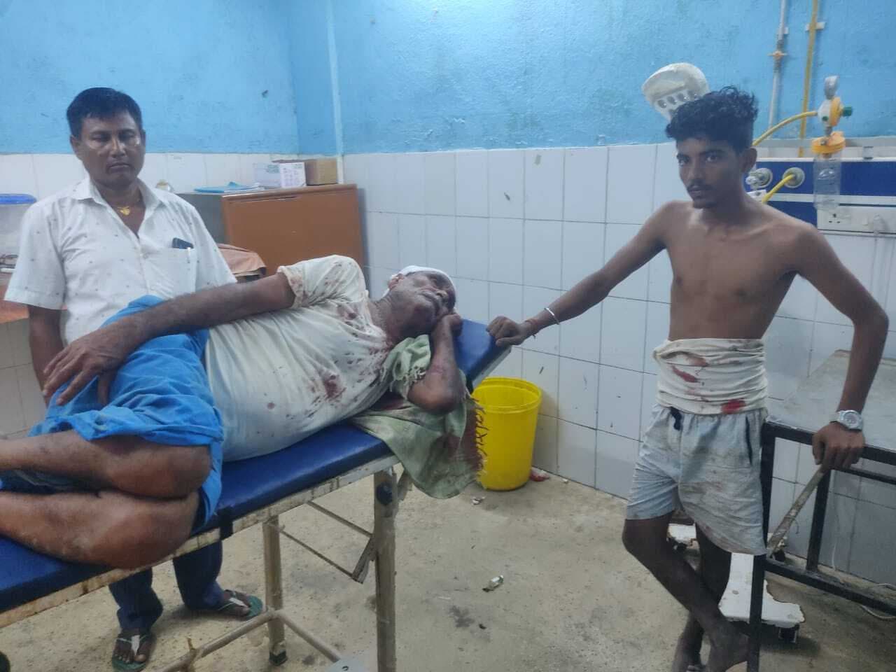 दो पक्षों में मारपीट, बुजुर्ग व्यक्ति गंभीर रूप से घायल