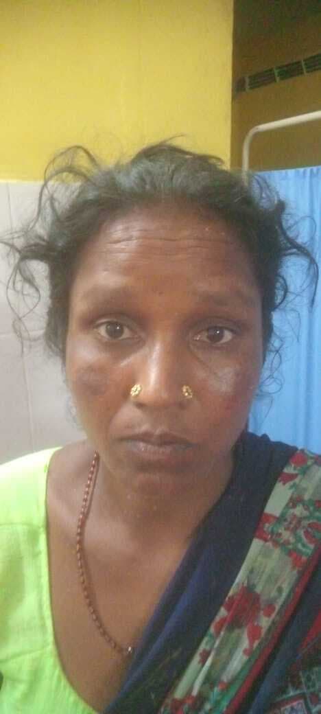 वज्रपात की चपेट में आने से युवती और महिला घायल