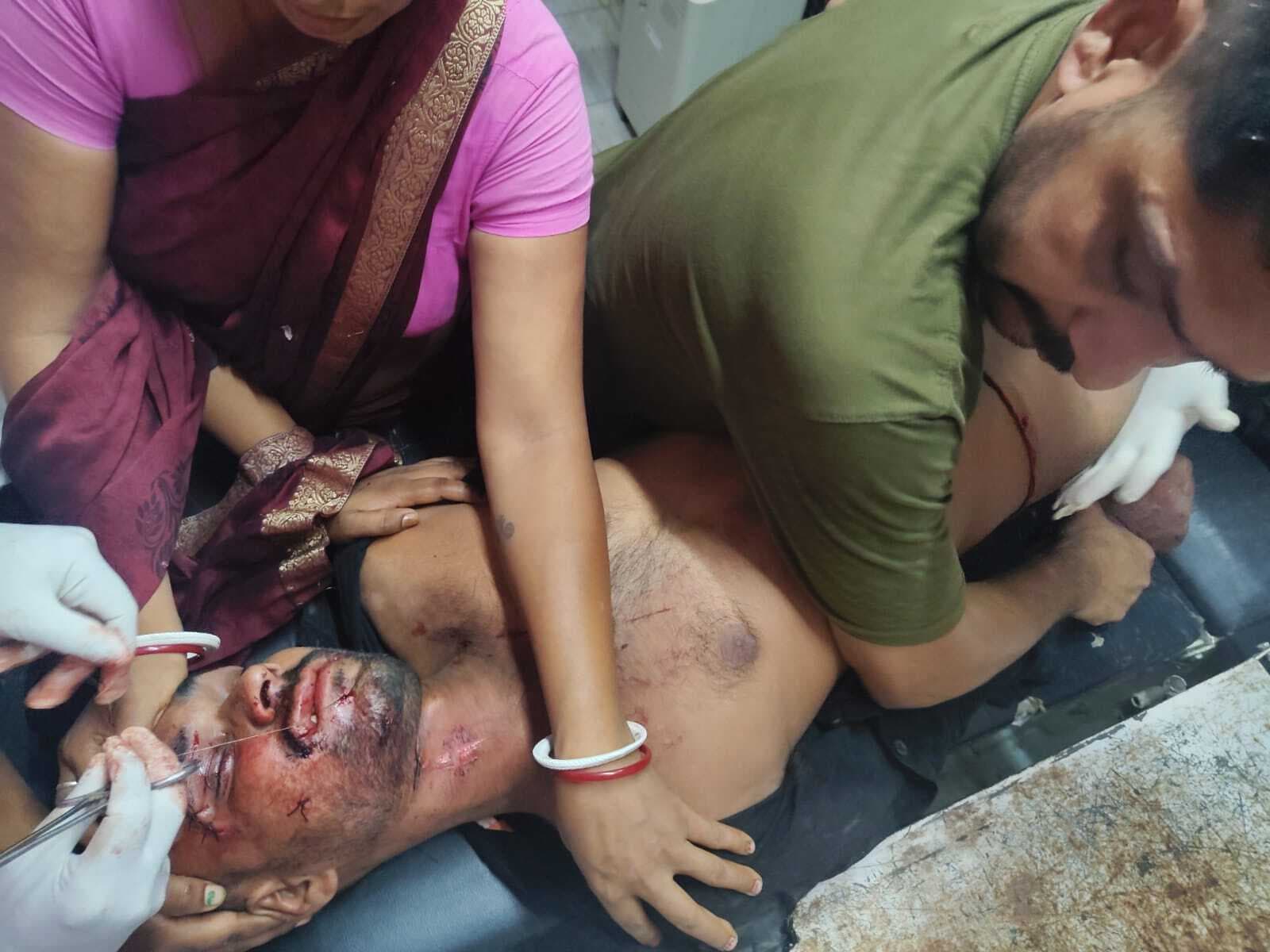 बाइक सवार युवक पेड़ से टकराया, गंभीर रूप से घायल