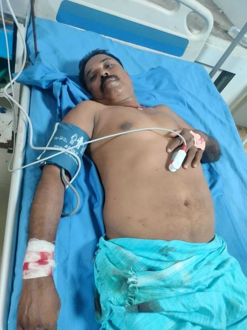 लूट का विरोध करने पर शिक्षक को बदमाशों ने मारी गोली, जख्मी