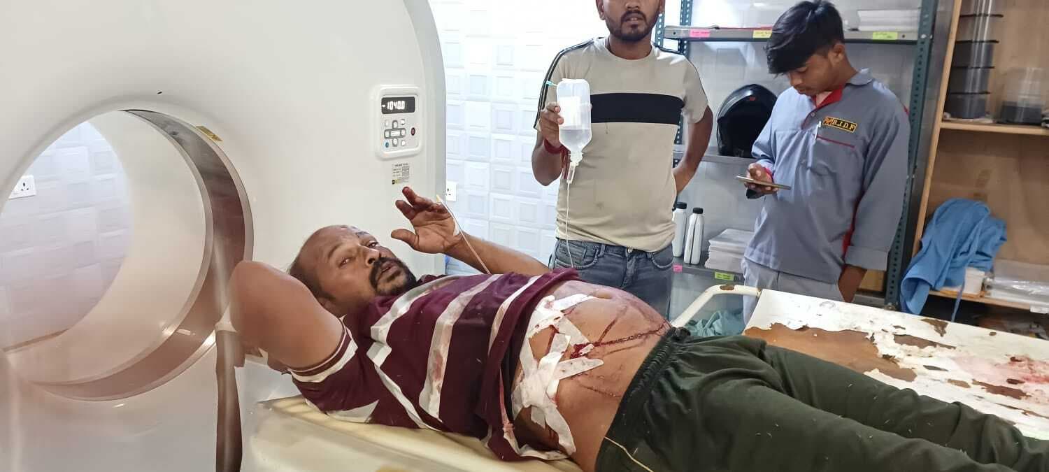 जंगल में बर्तन विक्रेता पर जानलेवा हमला, छह हजार रुपये लूटकर भागे बदमाश