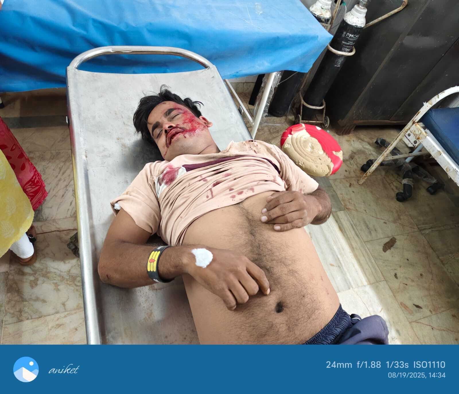 सारवां : अलग-अलग दुर्घटनाओं में महिला समेत चार घायल, रेफर