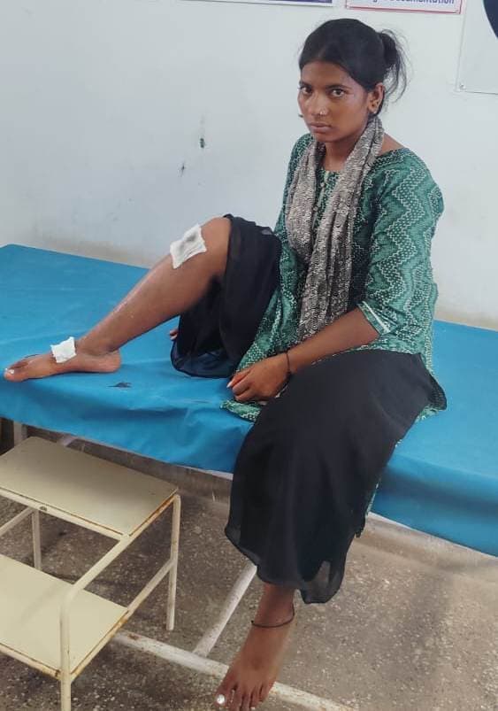 शंभुगंज में बाइक की ठोकर से युवती जख्मी