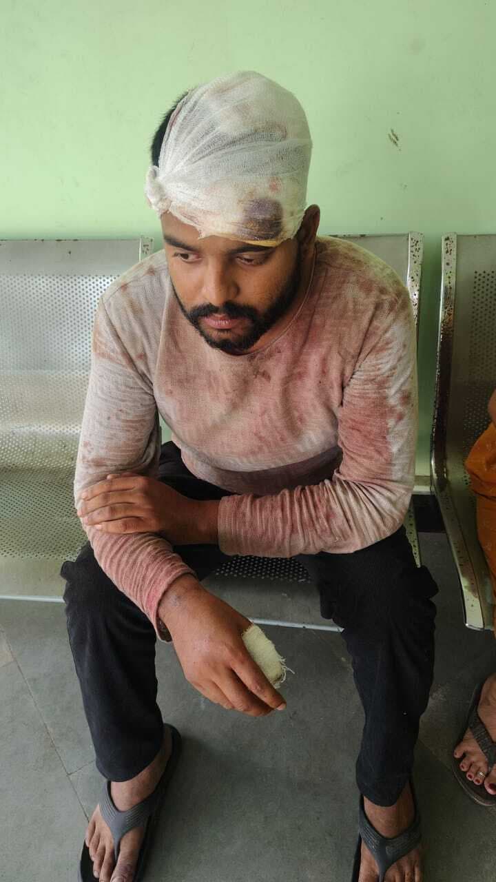 Jamshedpur News : गोलमुरी : डिलीवरी ब्वॉय की पिटाई कर मोबाइल व रुपये की छिनतई