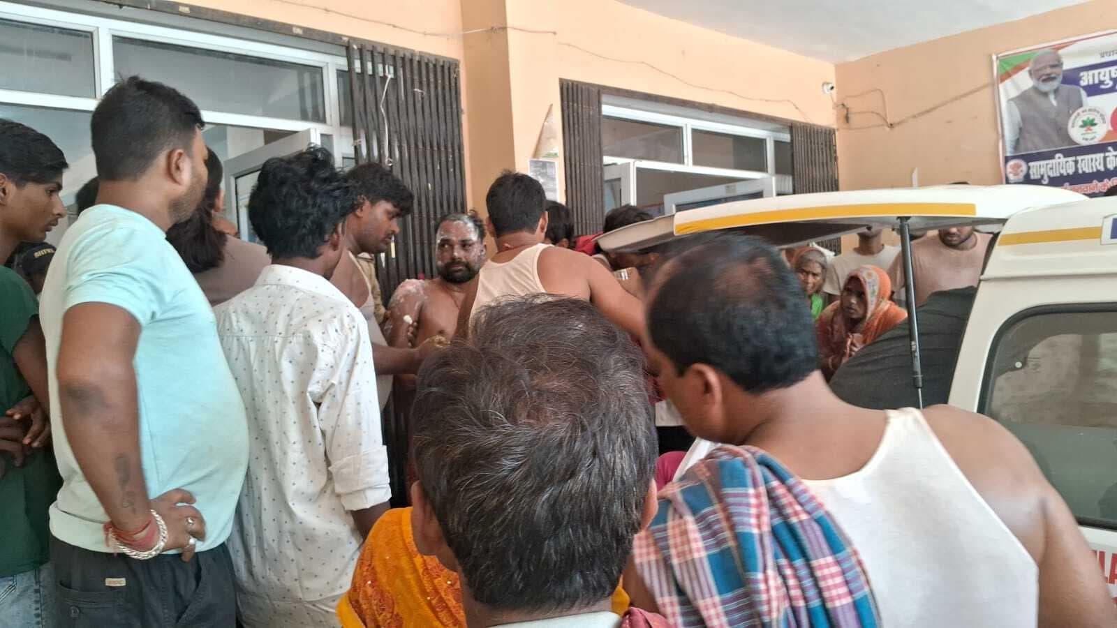 Samastipur News:हसनपुर में करंट लगने से झुलसा मानव बल रेफर