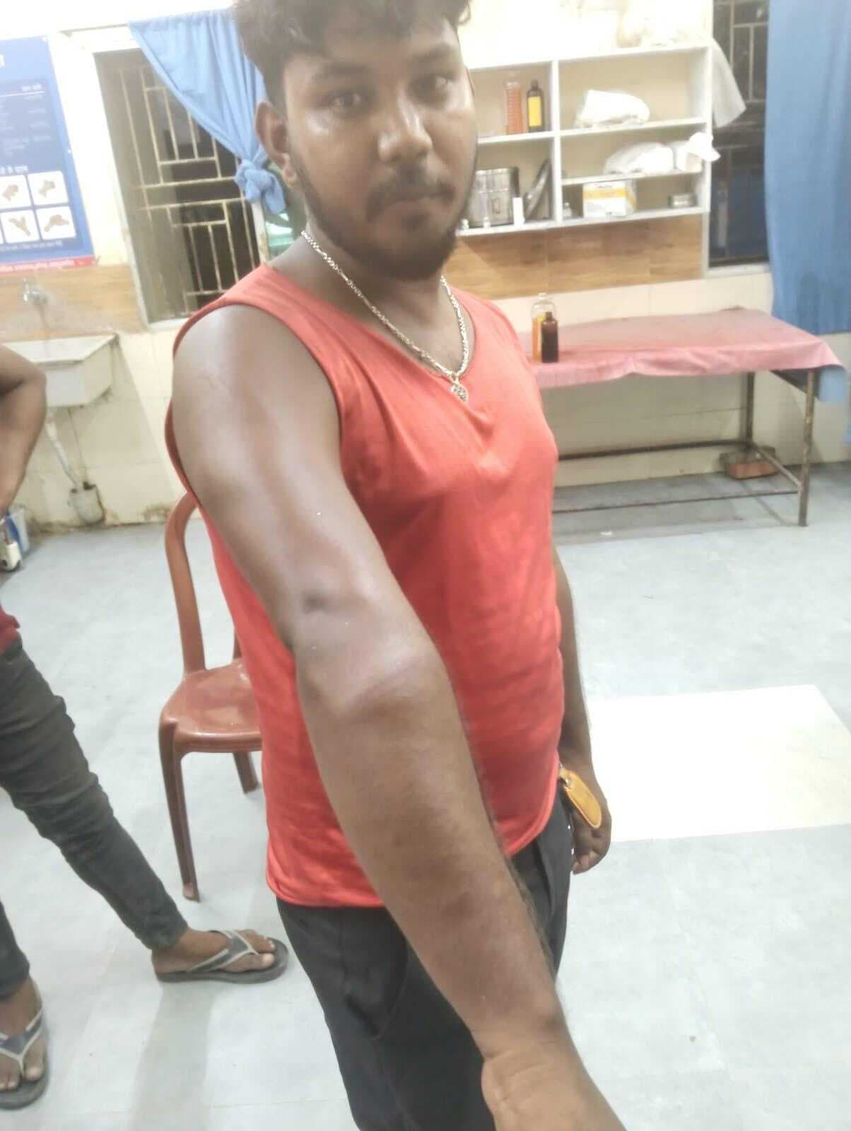 जांच के नाम पर मारपीट का आरोप