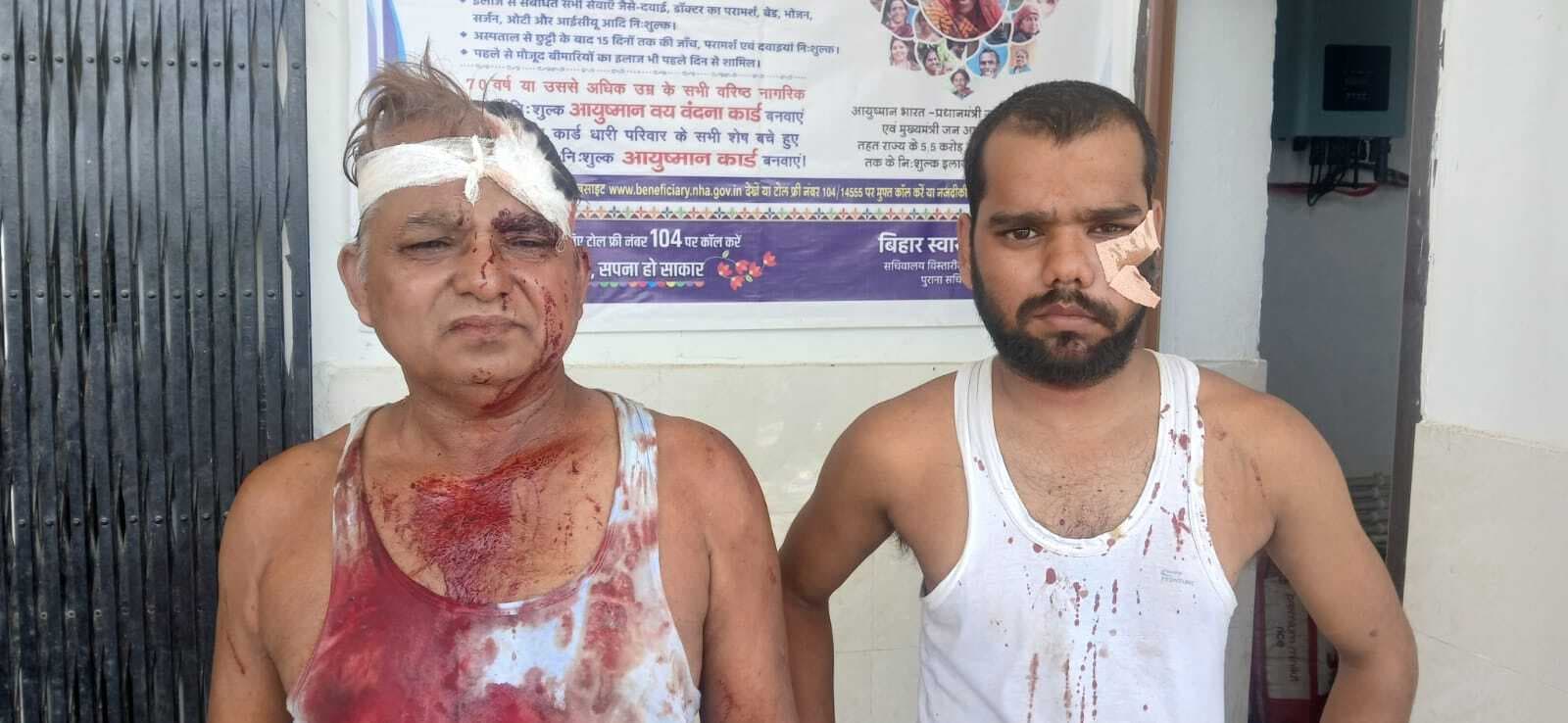 जमीन विवाद में मारपीट, पिता-पुत्र सहित तीन जख्मी