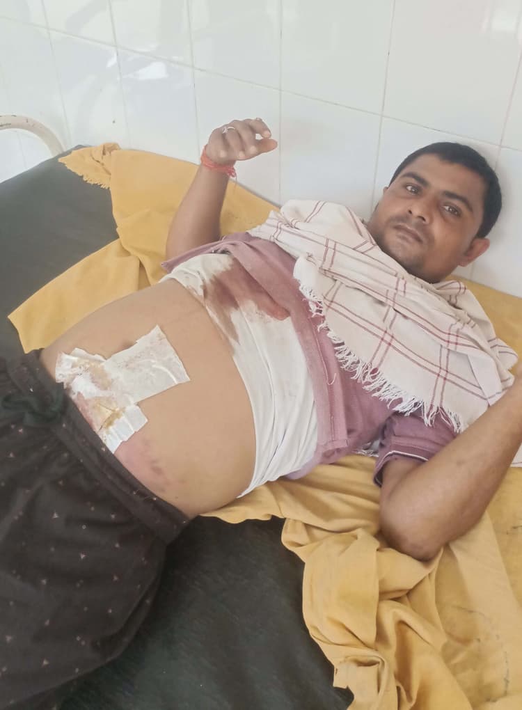 घात लगाये बदमाशों ने सफाईकर्मी को मारी गोली, घायल