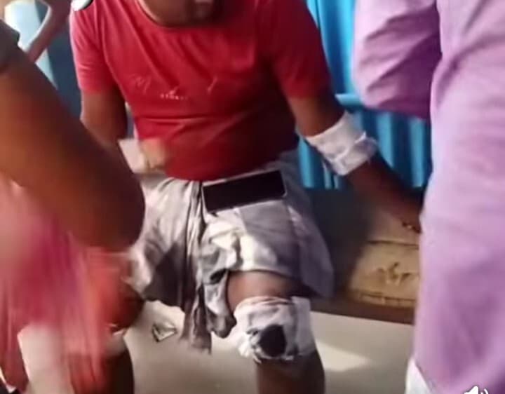 कार से टक्कर में बाइक चालक घायल, पीछे से आ रहे शिक्षक भी गिरे