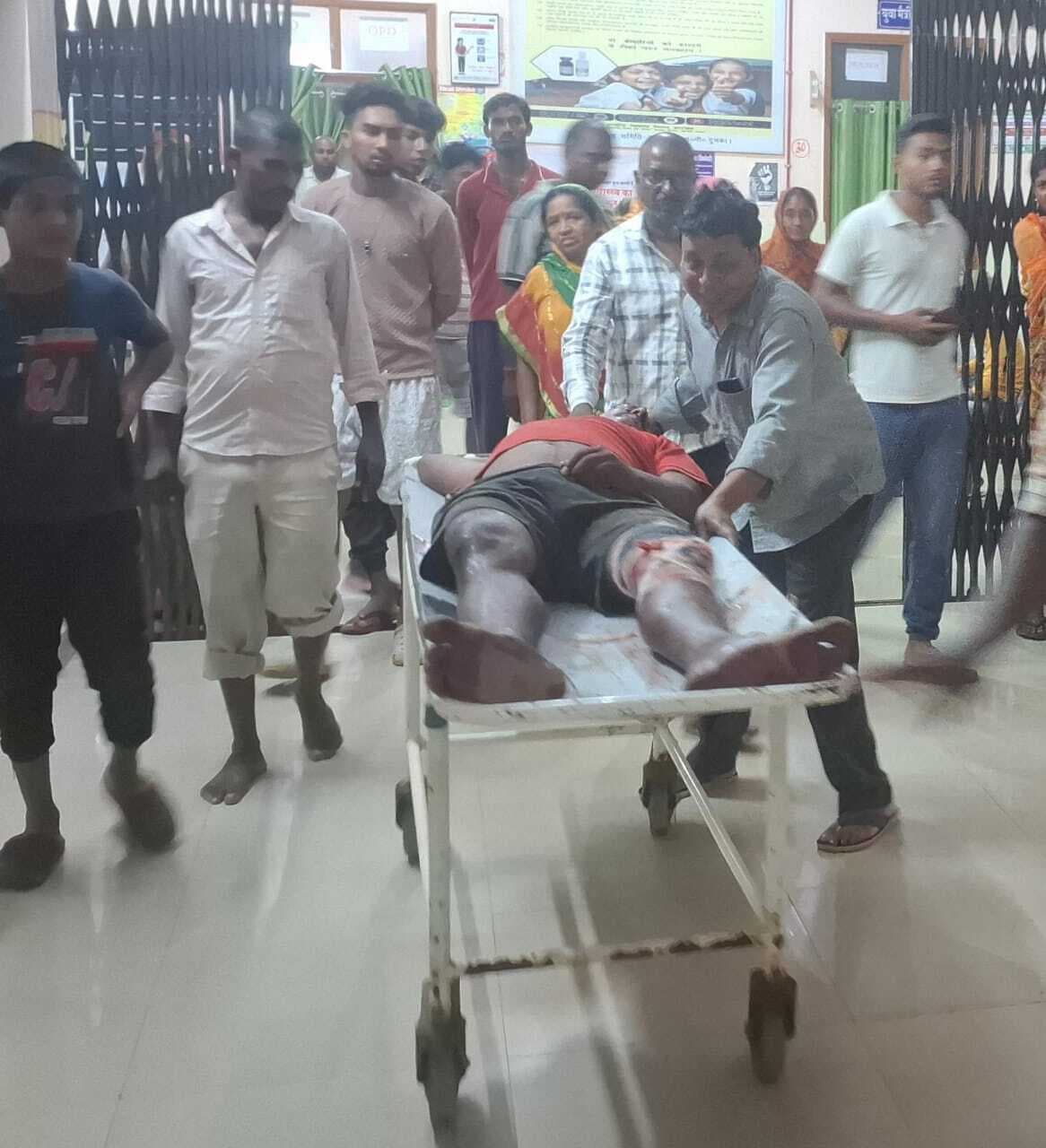 दो बाइक की टक्कर में महिला समेत तीन घायल, दो रेफर