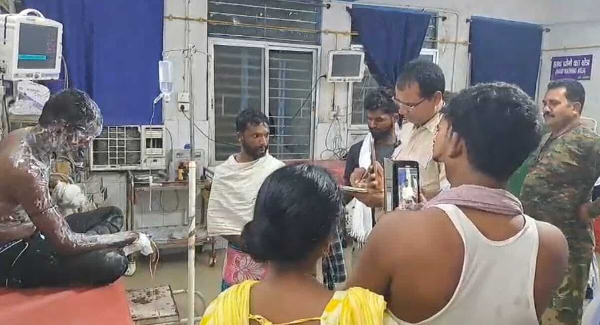 घर से बुलाकर प्रेमिका ने प्रेमी के शरीर पर डाला गर्म तेल, पटना रेफ़र