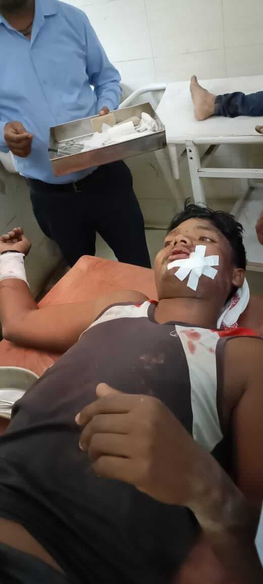 छत ढहने से दो मजदूर घायल