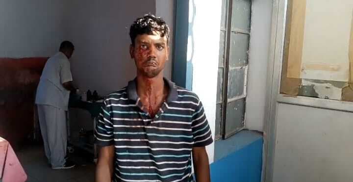 दबंगो ने मुक बधिर युवक को पीटकर किया जख्मी