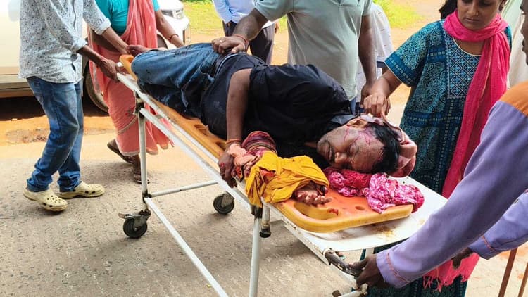 Deoghar news : जमीन विवाद में खूनी संघर्ष, भुजाली के वार से व्यक्ति का हाथ गंभीर रूप से कटा, ग्रामीण की दो अगुलियां कटीं