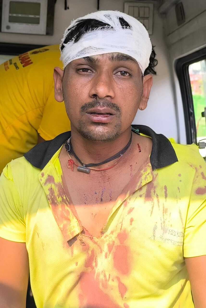 दो पक्षों में मारपीट, महिला समेत तीन घायल