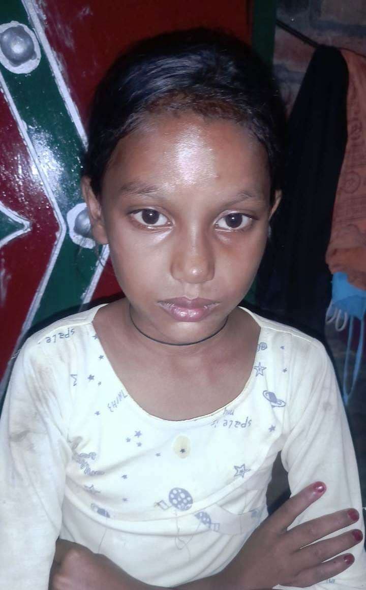 पटाखा जलाने में झुलसी बच्ची को चिकित्सक ने लिखा रैबिज का टीका