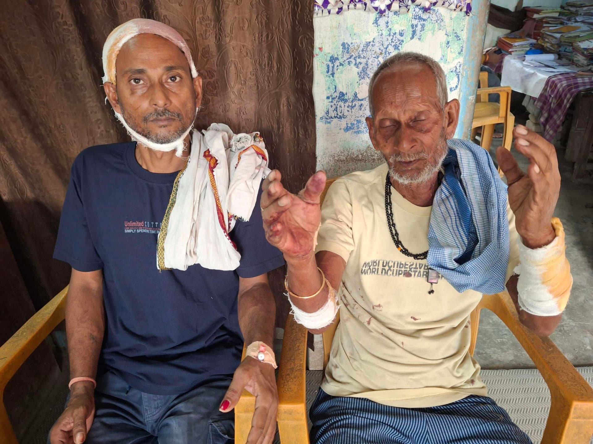Samastipur : पचभिंढा में कुदाल से प्रहार कर बाप-बेटे को किया जख्मी