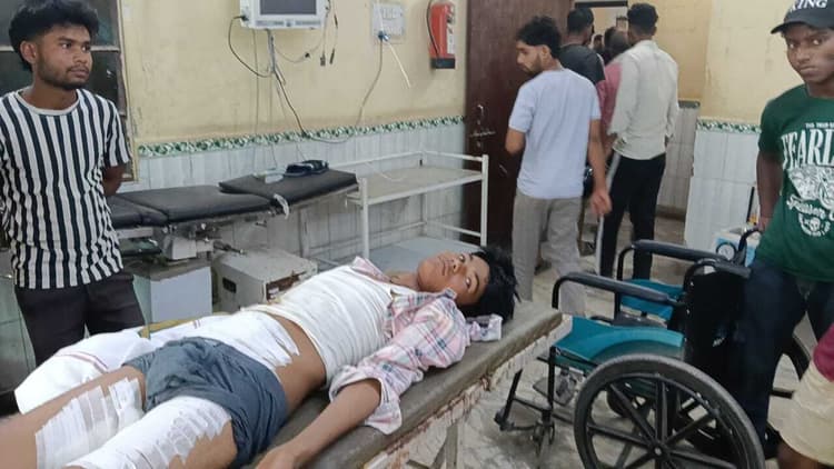 जादोपुर में छठ घाट पर टेंट लगाते समय किशोर को लगा करेंट, हालत गंभीर