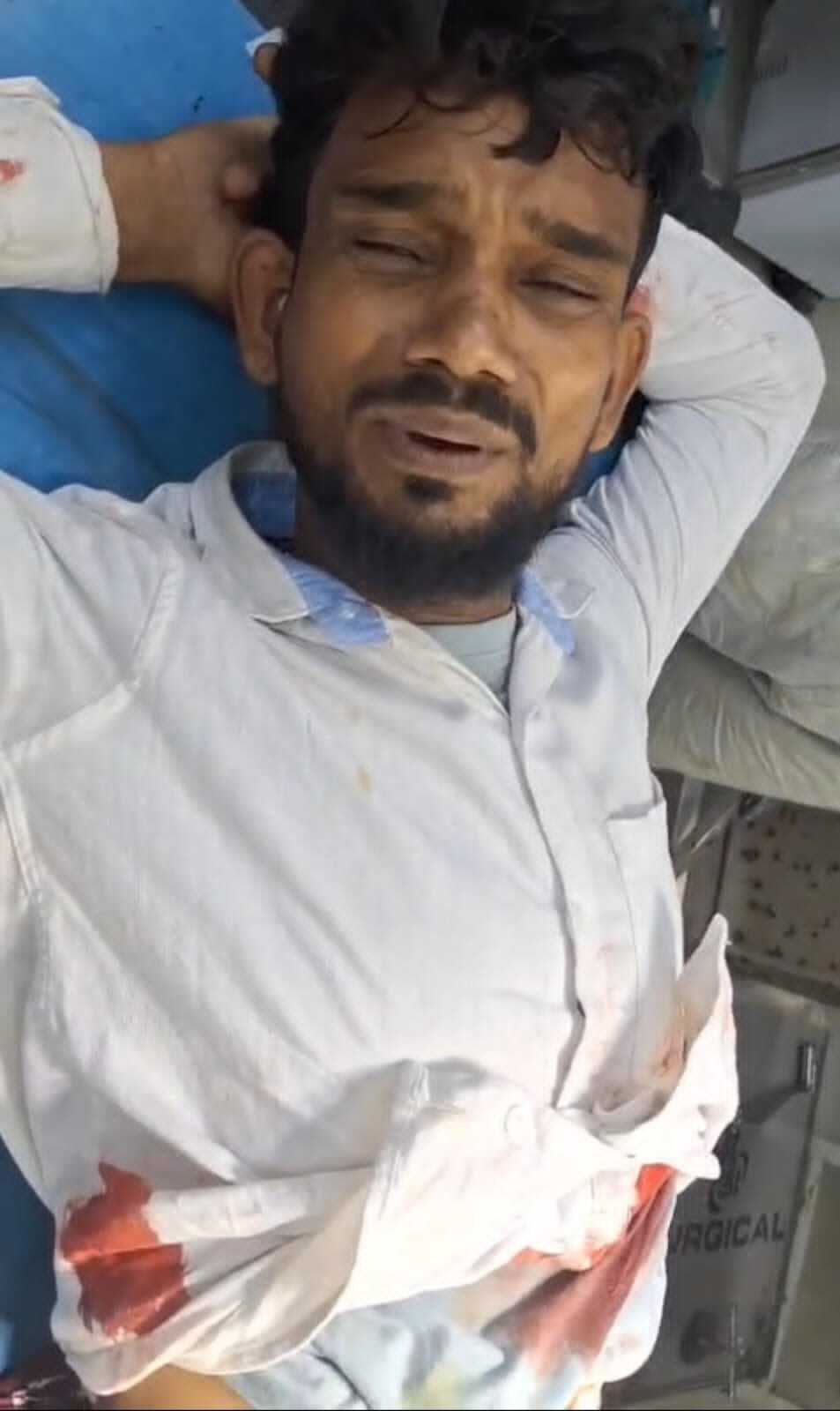 पाकुड़ में माइंस कर्मी को घर में घुसकर बदमाशों ने मारी तीन गोली, गंभीर
