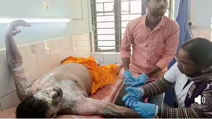 महिला ने युवक पर पेट्रोल छिड़क कर लगा दी आग, पटना रेफर