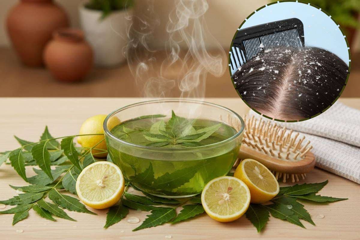 Natural Hair Care Tips: नीम और नींबू के पत्तों का पानी दूर करेगा डैंड्रफ और झड़ते बालों की समस्या - ट्राइ करें नेचुरल हेयर क्लीन्सर