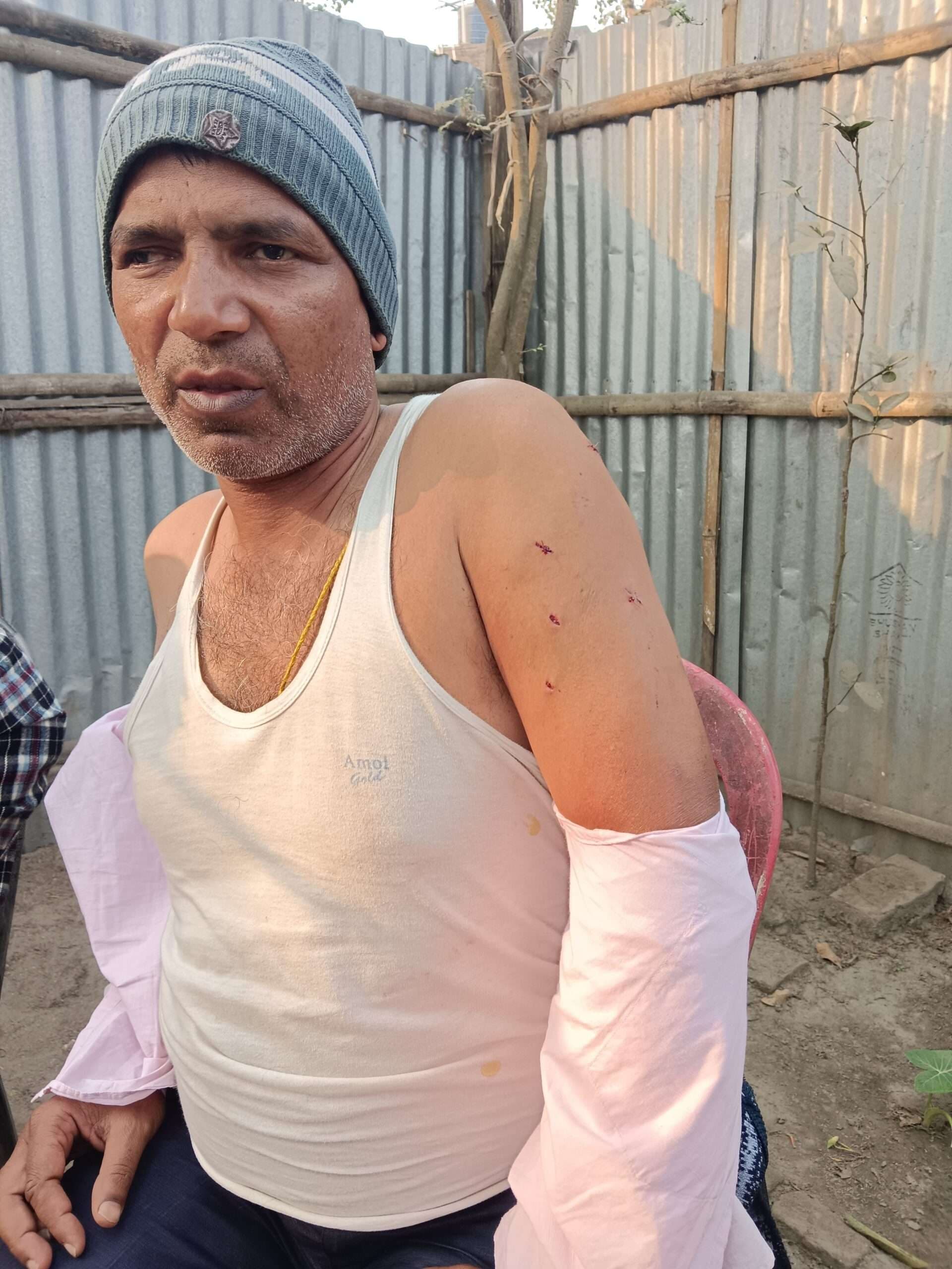 लूटपाट के दौरान अभियंता को मारा चाकू, जख्मी