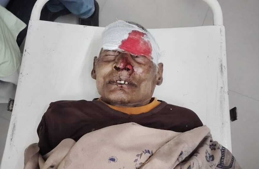 सड़क दुर्घटना में बुजुर्ग व बालक गंभीर रूप से घायल