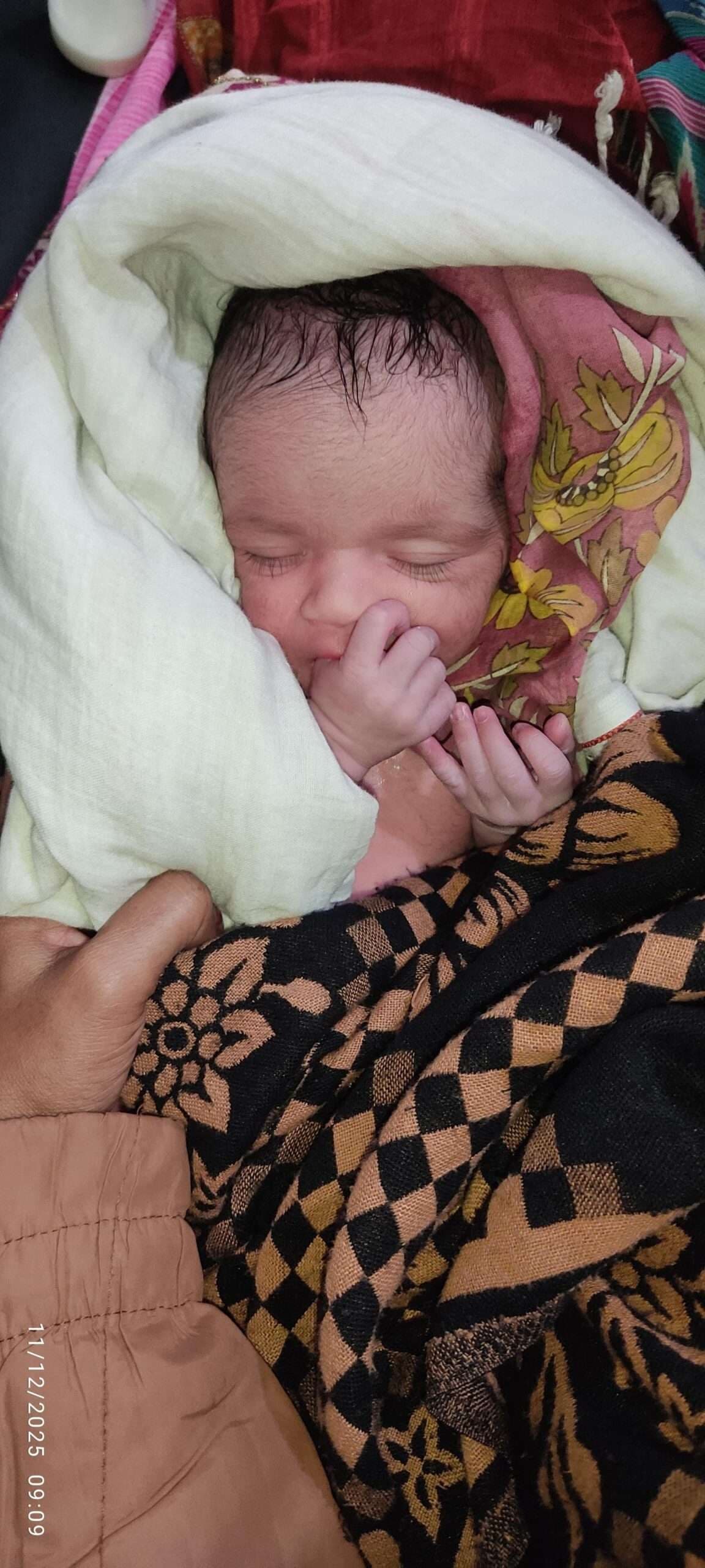 कोसी में आईवीएफ से पहली जुड़वां संतान जन्मी