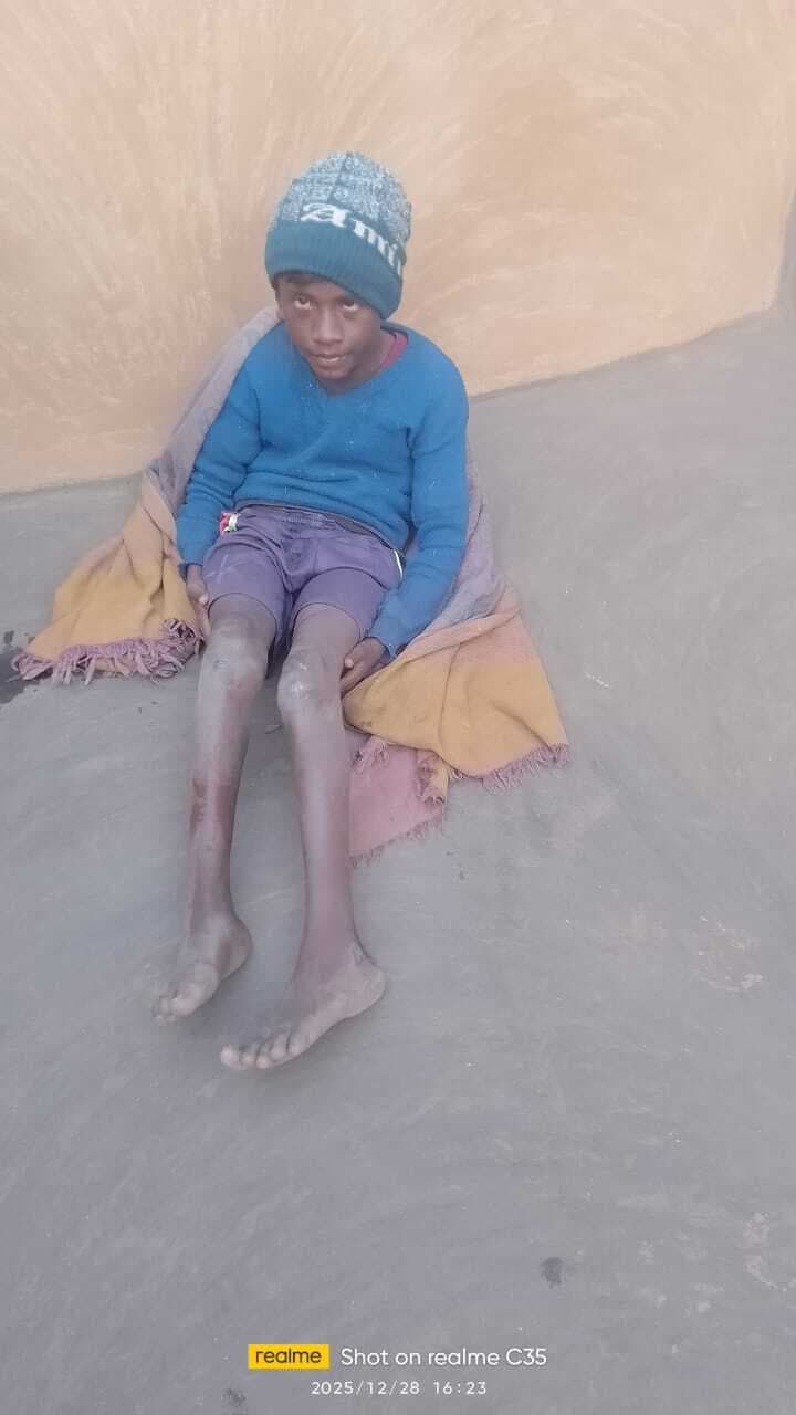 छात्र आशीष मुर्मू का होगा समुचित इलाज: मंत्री