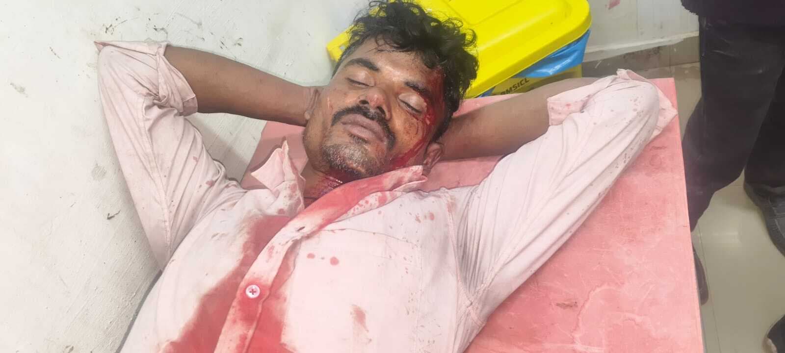 विवाद में हुए मारपीट में युवक घायल