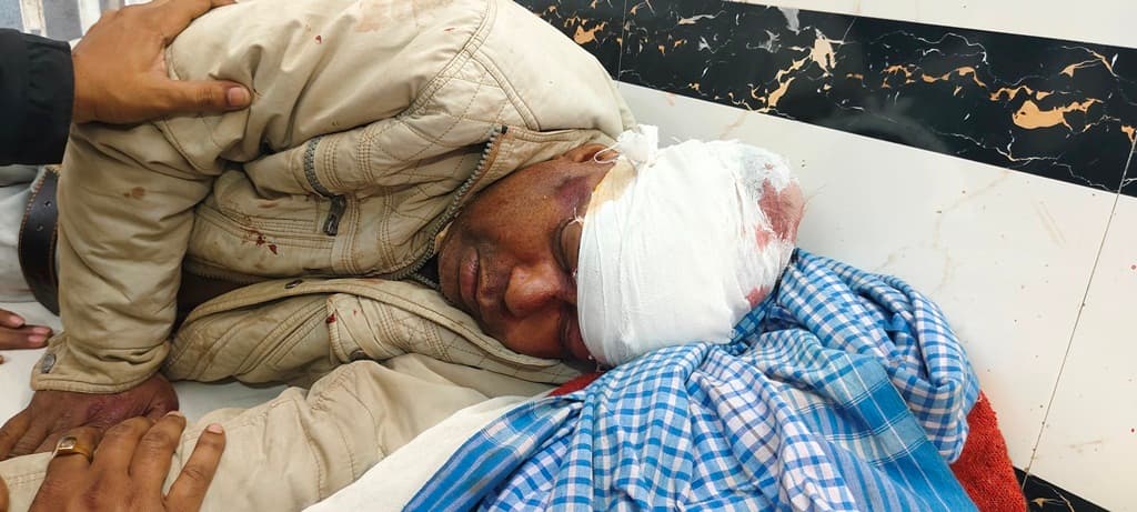 सिमरा मोड़ पर कुत्ते को बचाने में घायल हुआ बाइक सवार